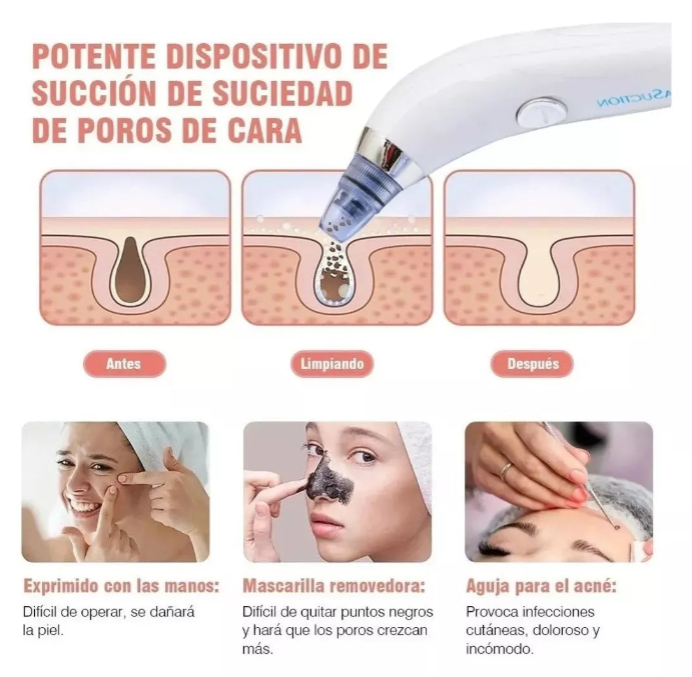 PoreXpert PRO