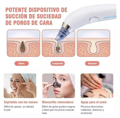 PoreXpert PRO